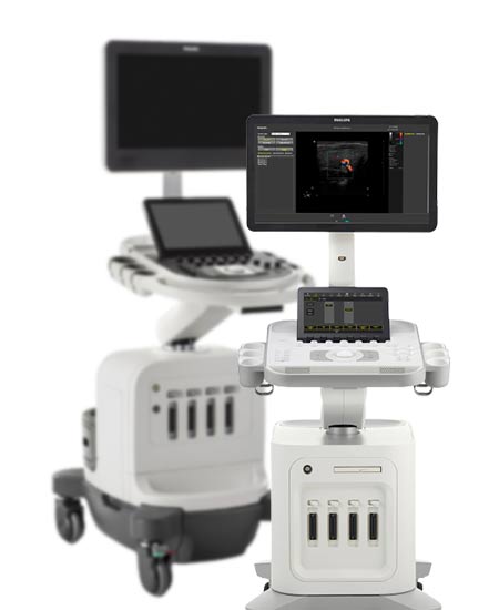 ULTRASSOM-PHILIPS